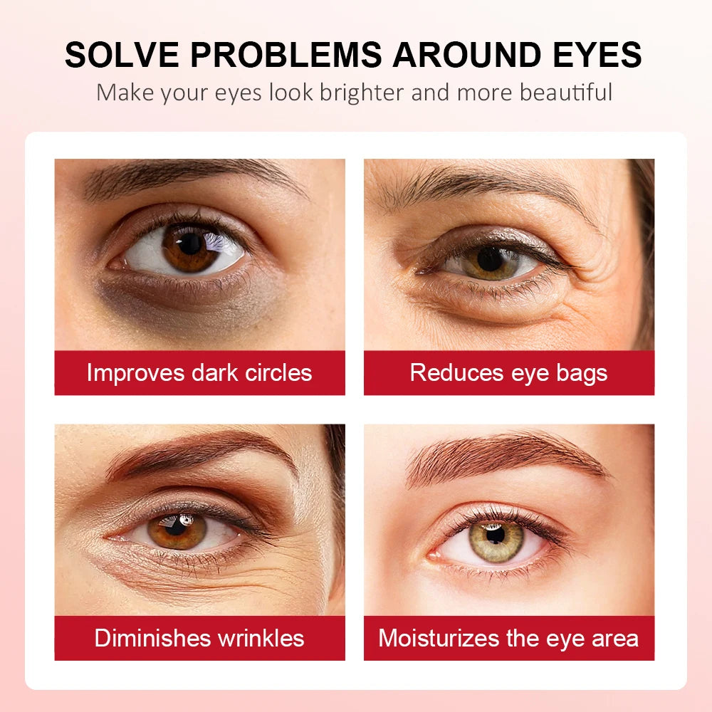 Retinol Eye Cream Lightening